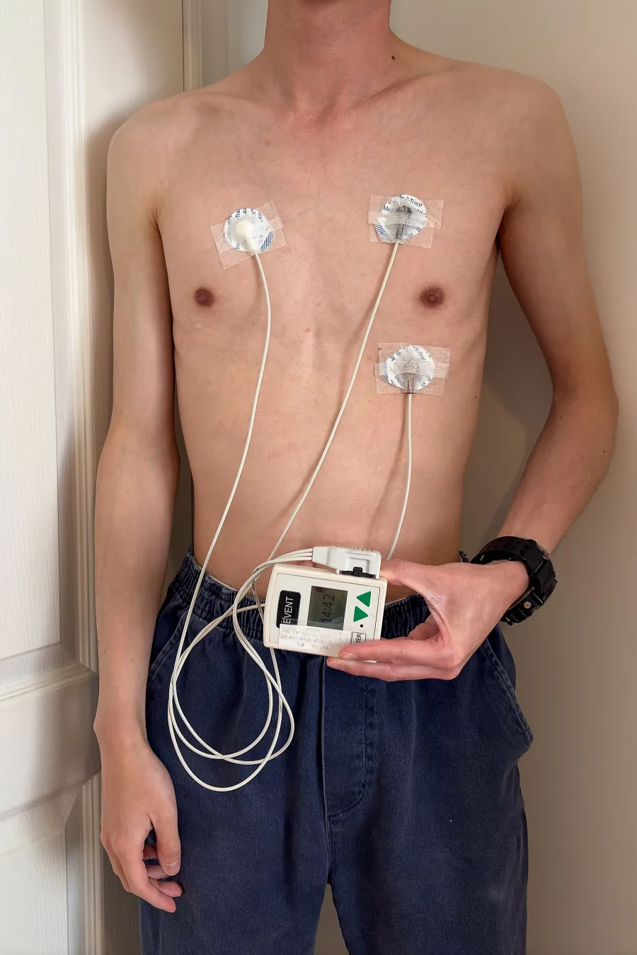 A patient wearing a modern 3-lead Holter monitor